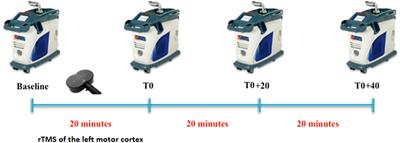 Low-Frequency rTMS of the Primary Motor Area Does Not Modify the Response of the Cerebral Cortex to Phasic Nociceptive Stimuli